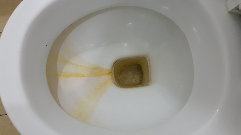 Urine stains in toilet