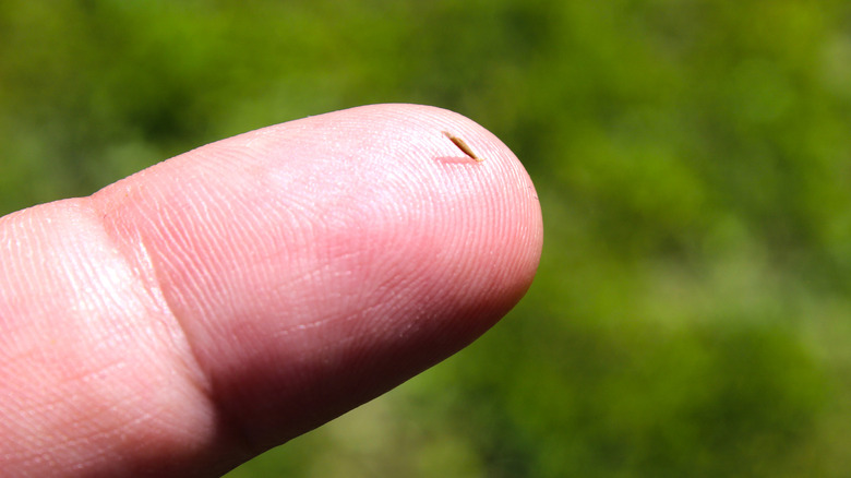 wood splinter in a finger