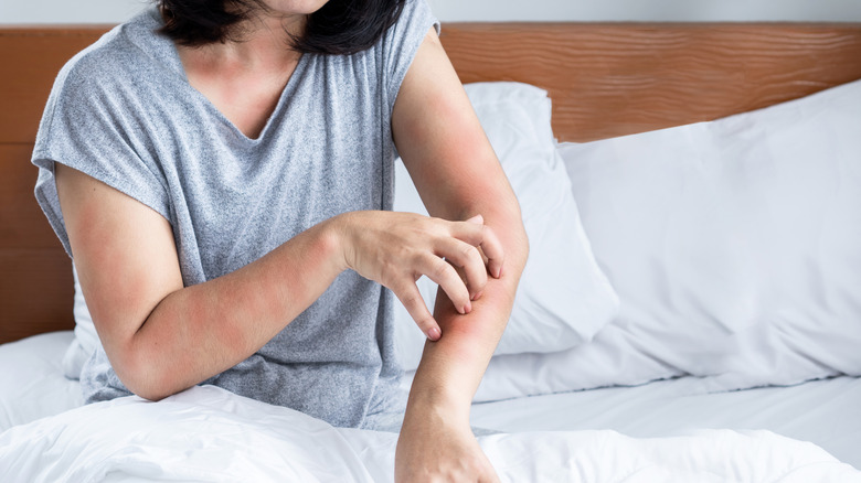 Woman scratching skin in bed