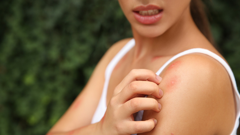 Young woman itching shoulder