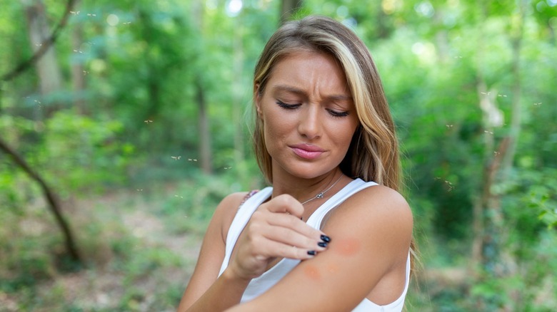 lady with an insect bite