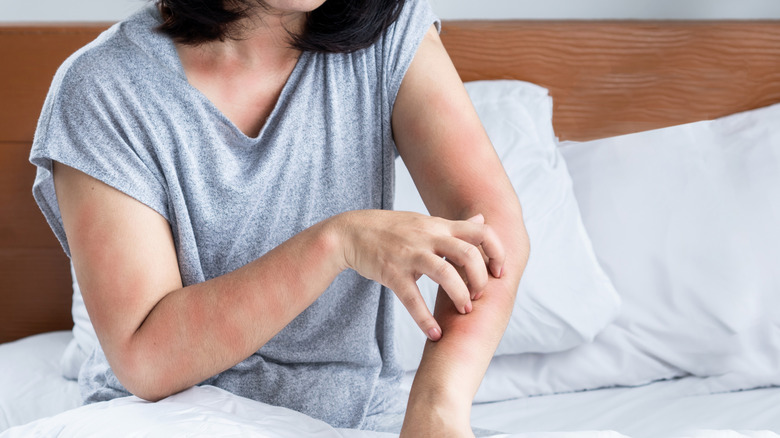 Woman scratching red itchy skin in bed