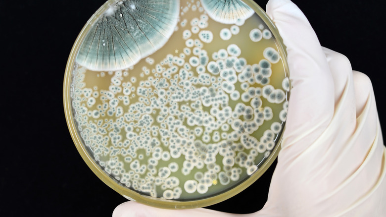 colonies growing in petri dish